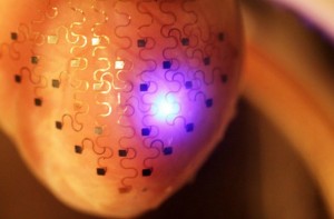 Pacemaker could be replaced by 3-D heart sock