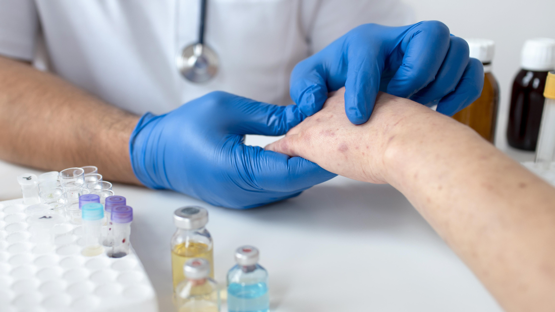 Tratamiento de la leishmaniasis