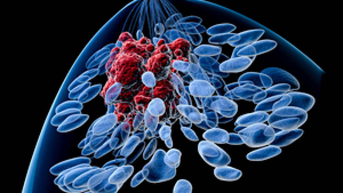 Hormone Cancer Studies