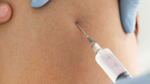 Stomach Photo Being Injected with Vaccine for Ebola Trial Patient