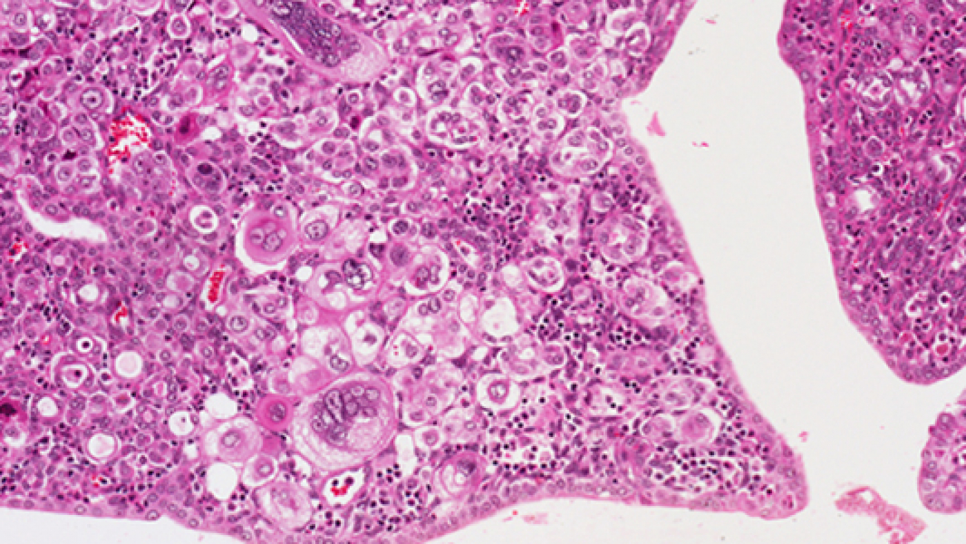 Endometrial-Post