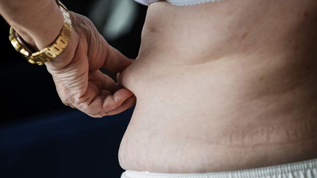 Terapia contra la obesidad