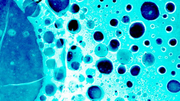 Picture taken from: http://www.dddmag.com/news/2016/12/mystery-molecule-key-inhibiting-colon-cancer