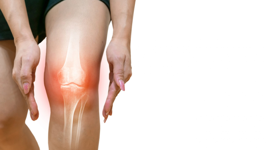 Human leg Osteoarthritis inflammation Of bone joints