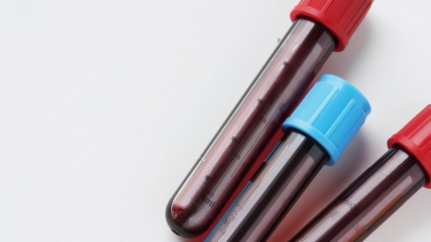 Closeup of blood tube test