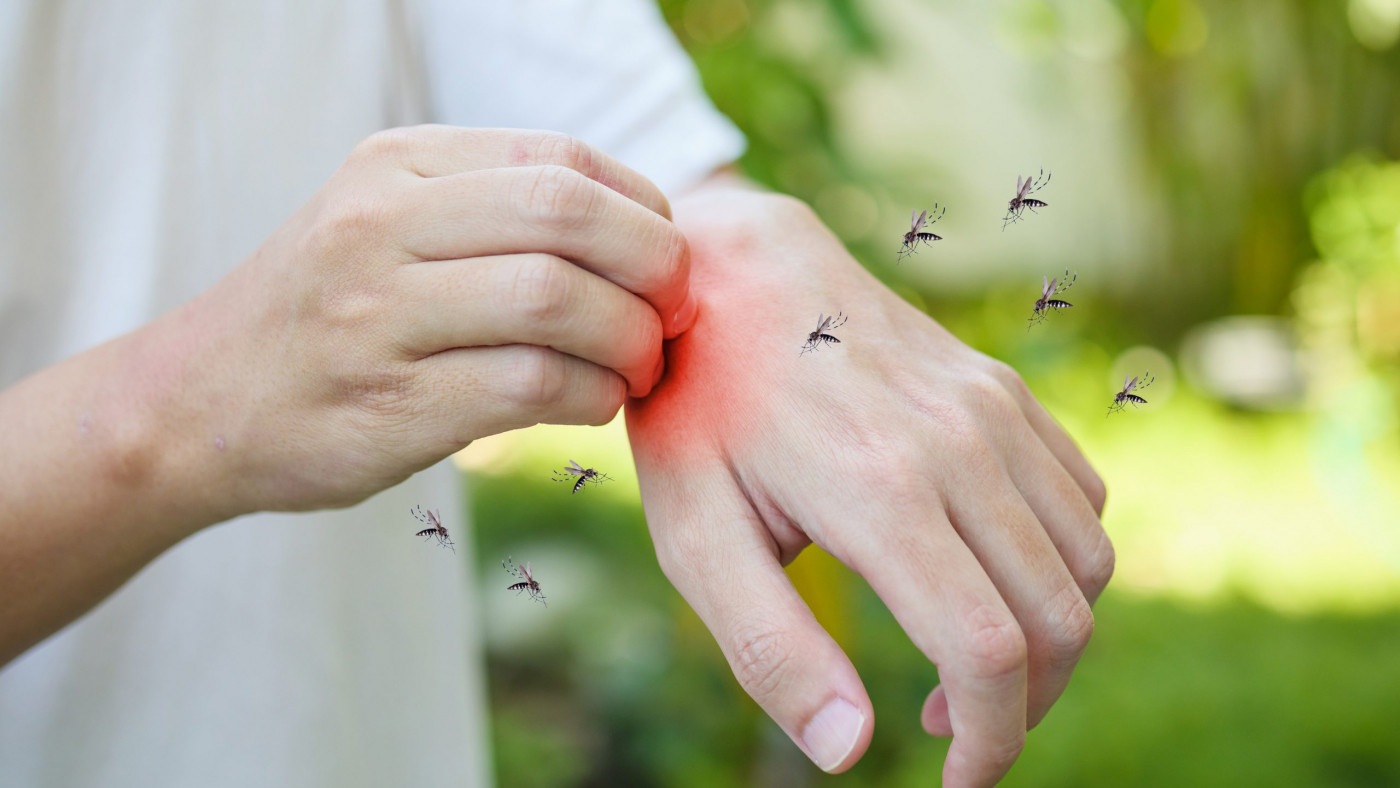 Man itching and scratching on hand from allergy skin rash cause by Mosquitoes bite