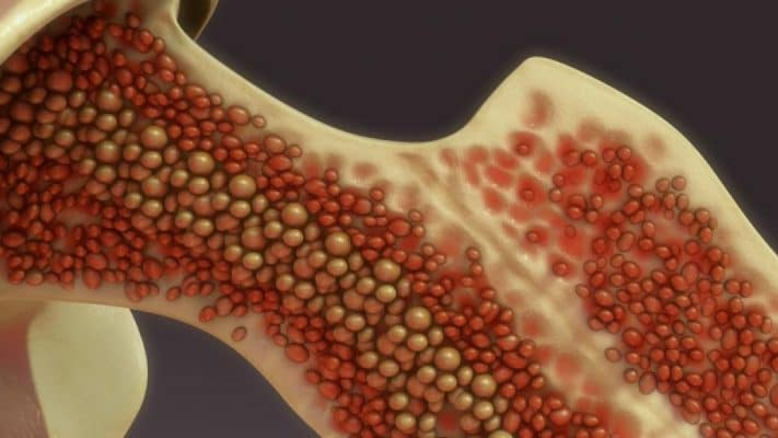 Fuente: https://abm-website-assets.s3.amazonaws.com/biosciencetechnology.com/s3fs-public/styles/hero/public/featured_image/2018/06/bone%20marrow_Shutterstock_featured.jpg?itok=ub83q-FK