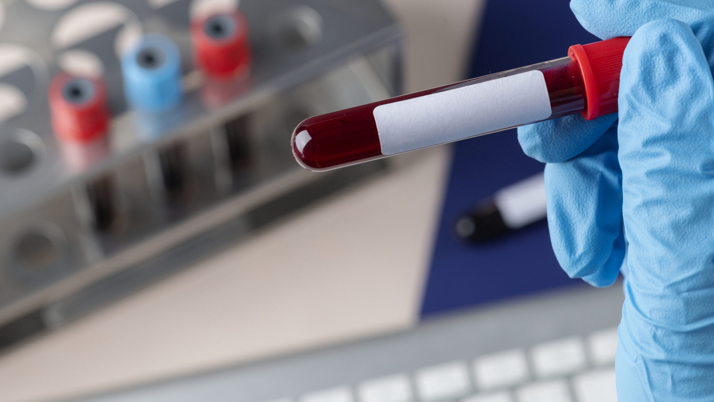 Surgeon holding a blood test