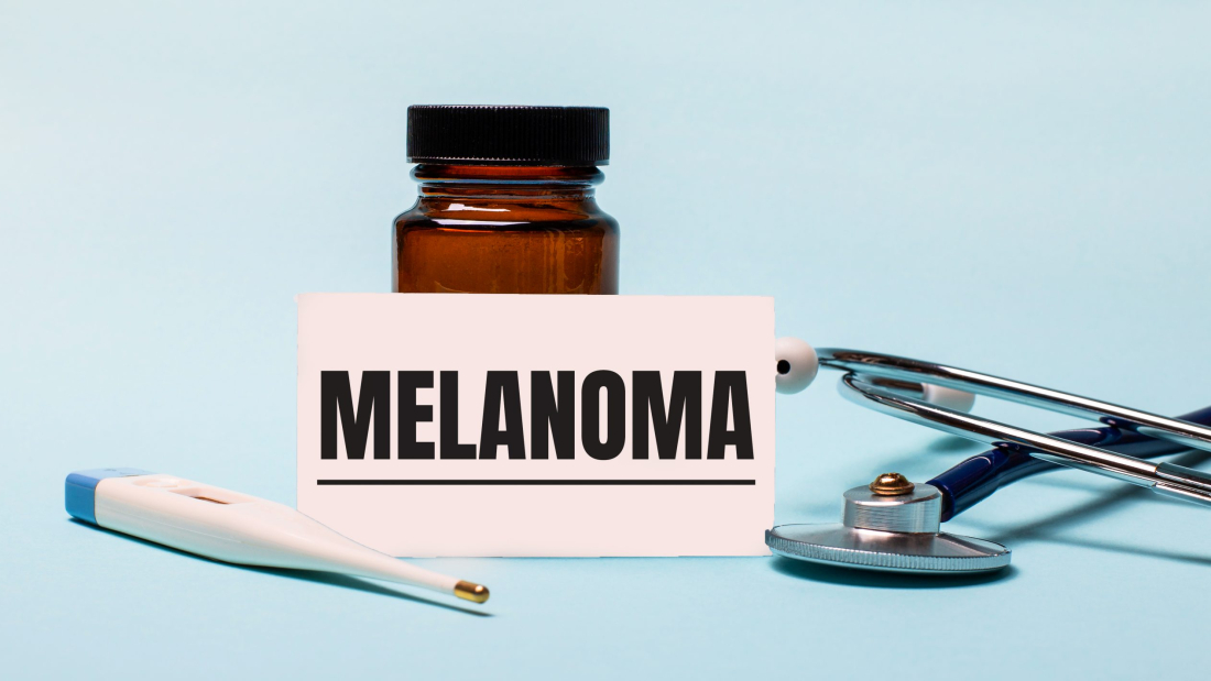 On a blue background - a bottle for pills, a stethoscope, an electronic thermometer and a card with the inscription MELANOMA. Medical concept