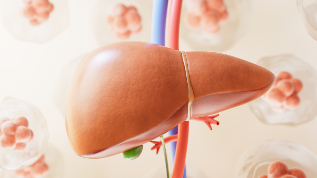 Chronic liver disease
