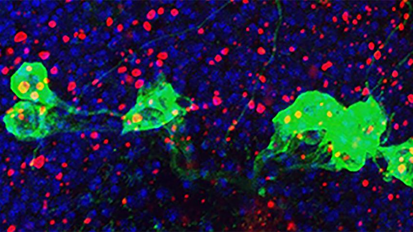 NIH scientists showed how the immune system may be a culprit in the damage caused by aging brain disorders.