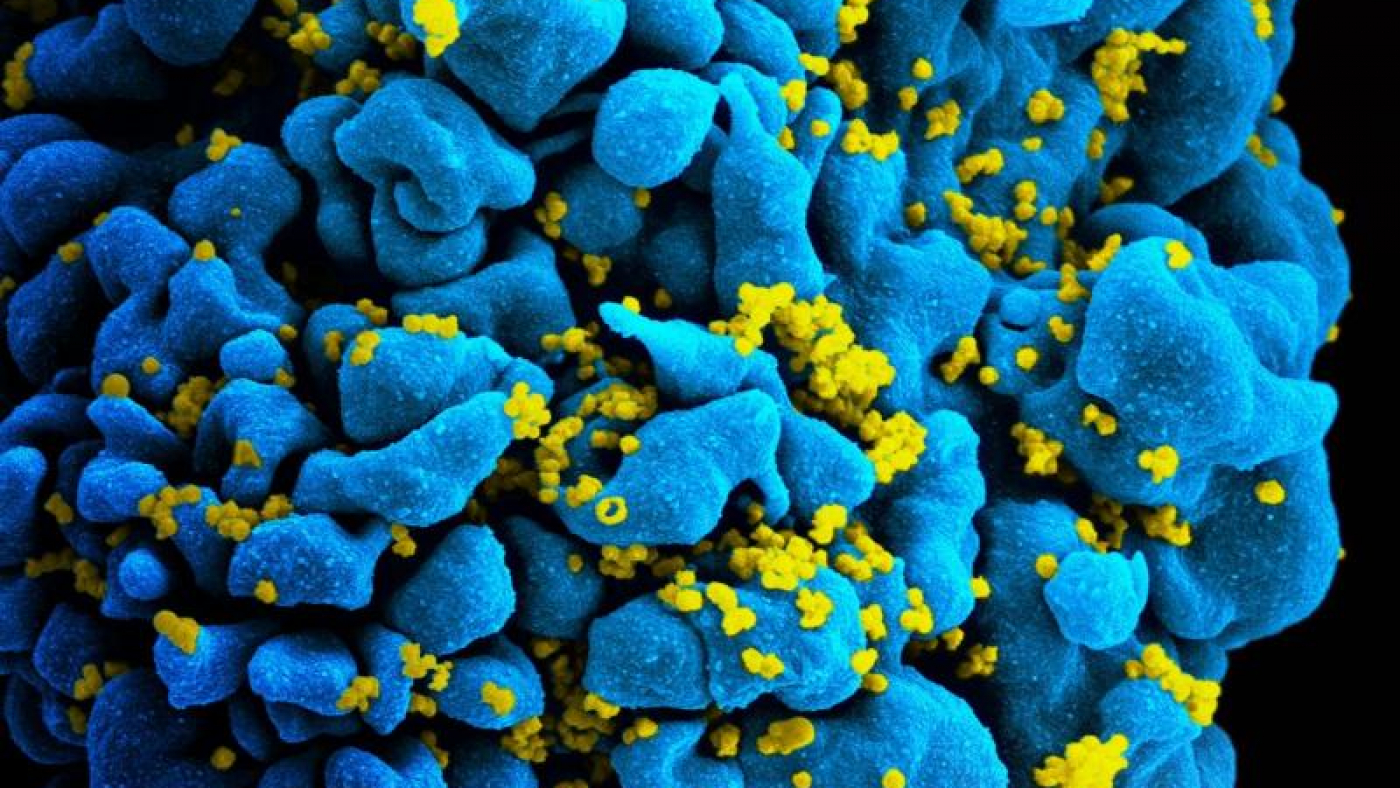 NIH-Supported Scientists Develop Tool to Measure Success of HIV Cure Strategies