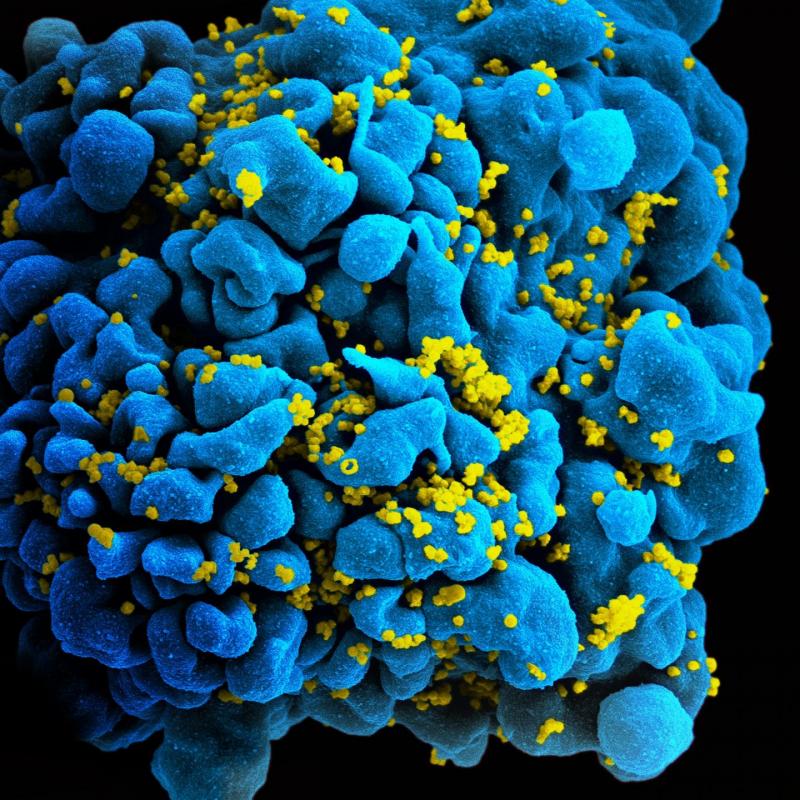 NIH-Supported Scientists Develop Tool to Measure Success of HIV Cure Strategies