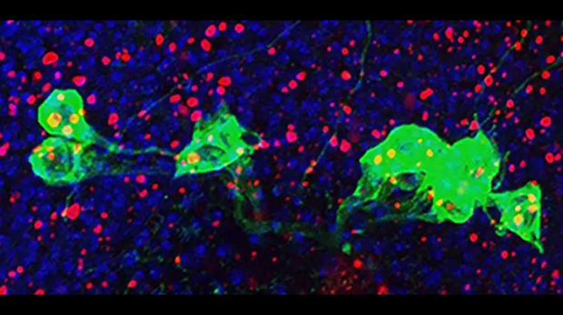 NINDS Giniger Immunity Illustration | Brain Disorders