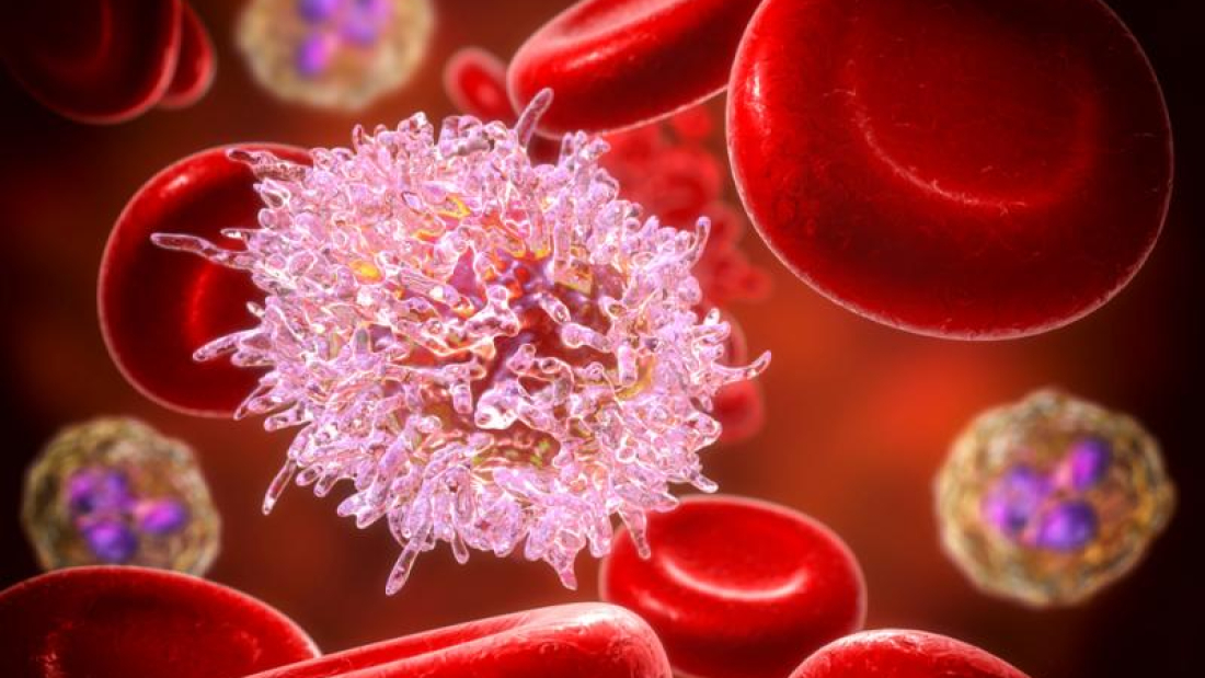 Leucemia