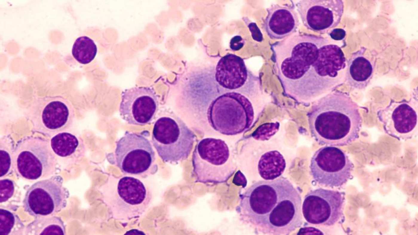 Image Source: https://www.rdmag.com/news/2019/01/cutting-melanomas-escape-routes