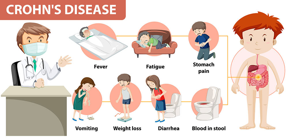 Crohns Disease Symptoms and Affects Illustration