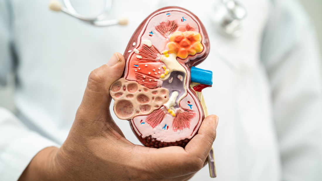 enfermedad renal (ERC) fallida
