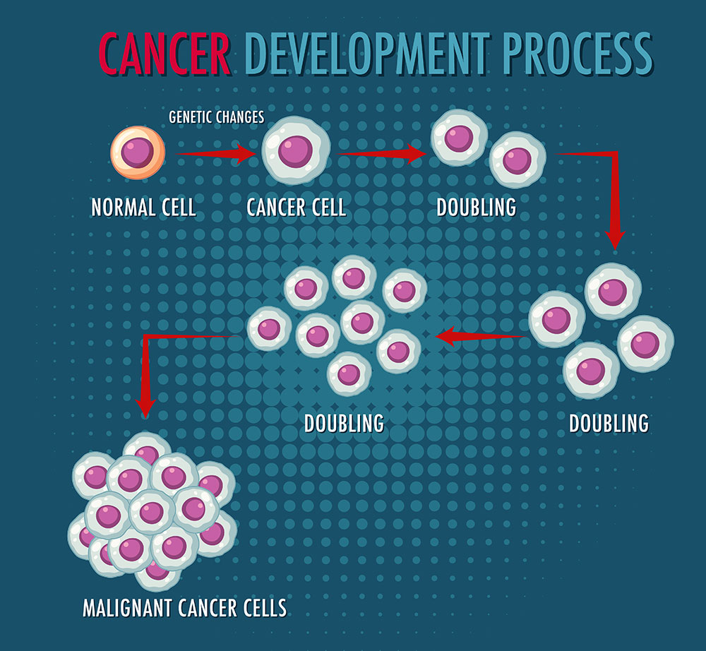 Cancer Development Process Illustration