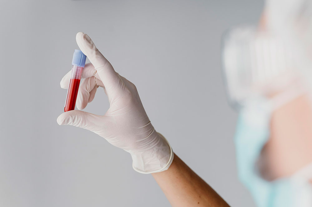 Designing a Blood Test Woman in Lab with Blood Vial