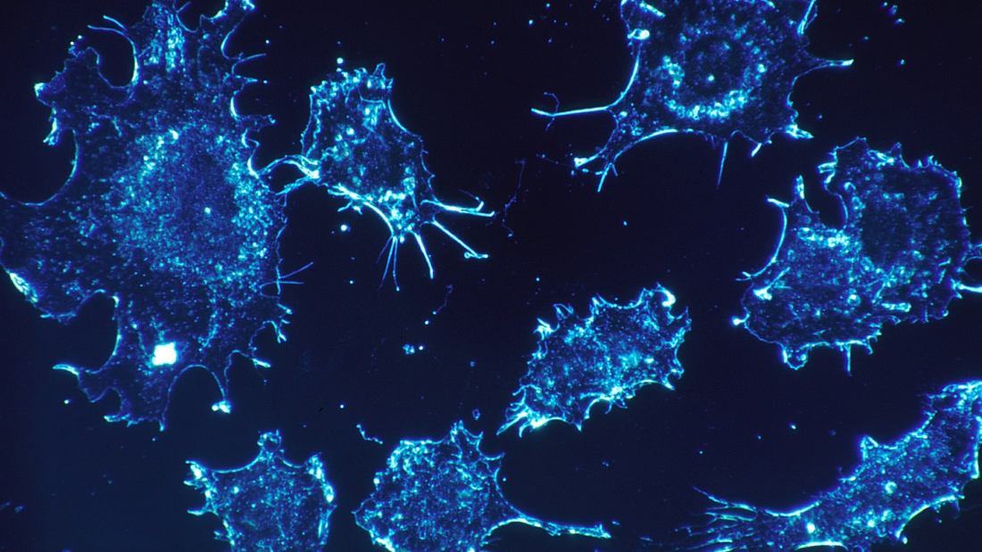 investigación del cáncer