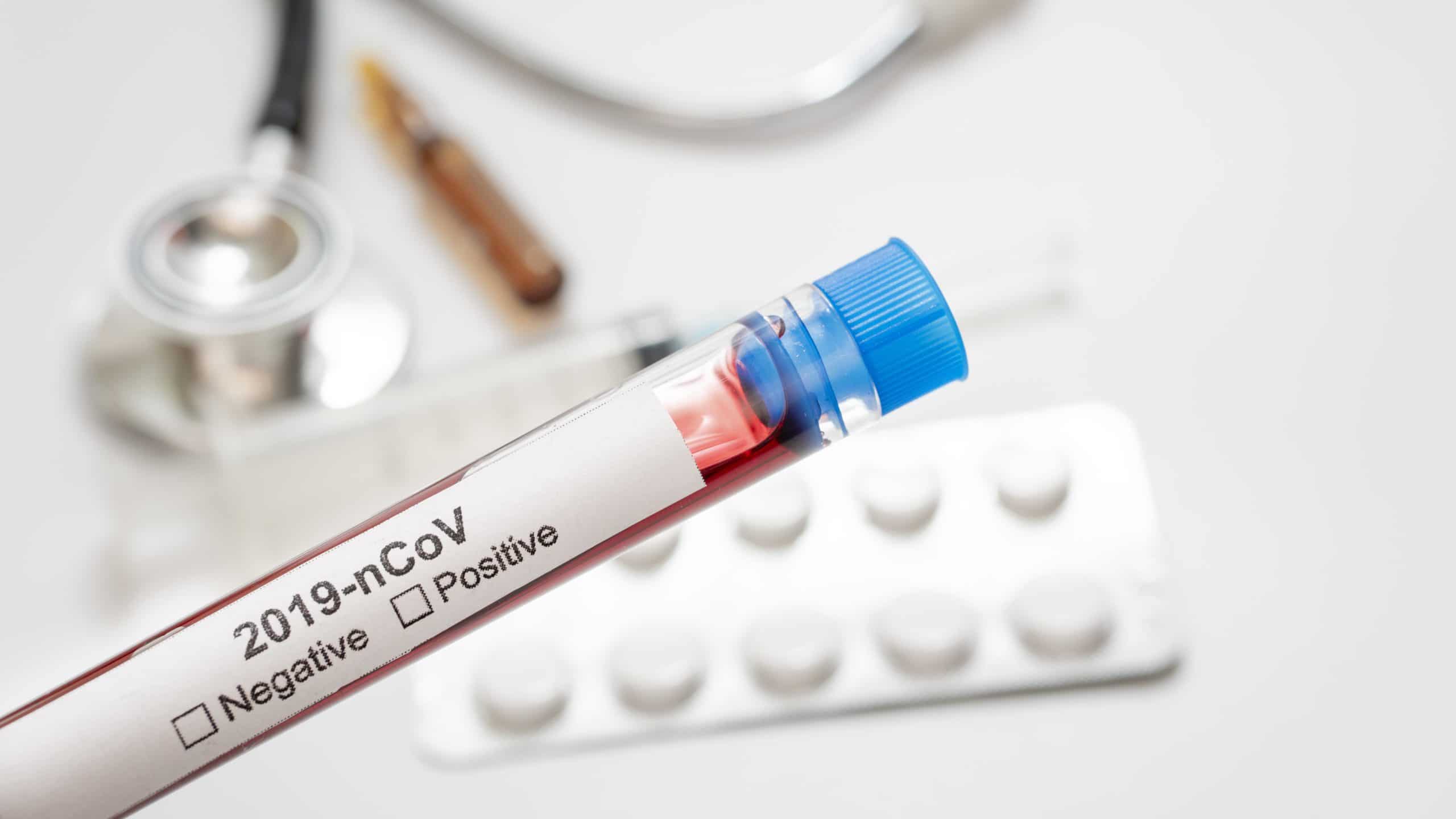 Johnson & Johnson: Clinical study of potential coronavirus vaccine could start by end of year