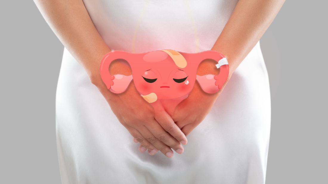 Endometriosis