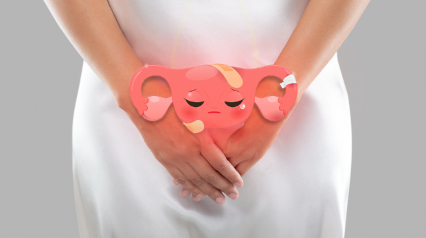 Endometriosis