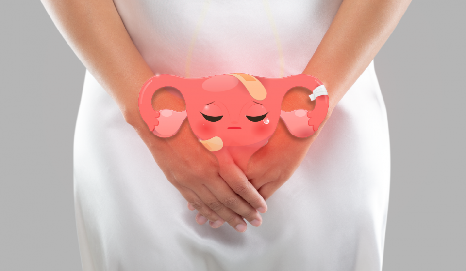 Endometriosis