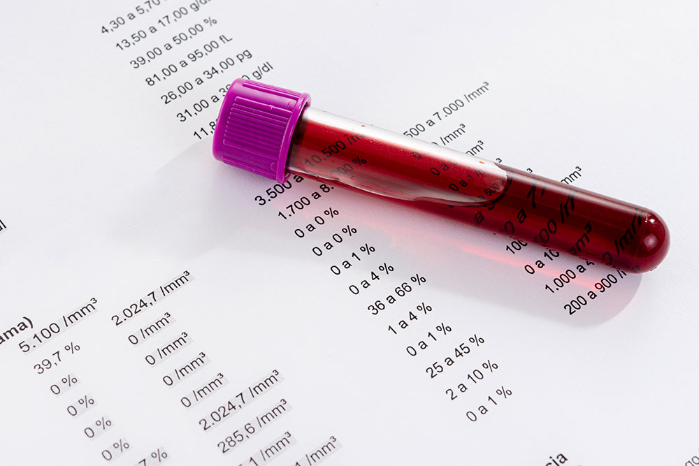 Blood Tube wth Test Results from Clinical Trial