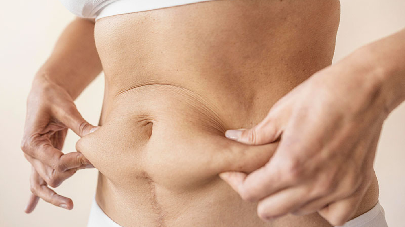 Obesity Man Hods Belly Overweight