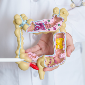 Colorectal cancer treatment